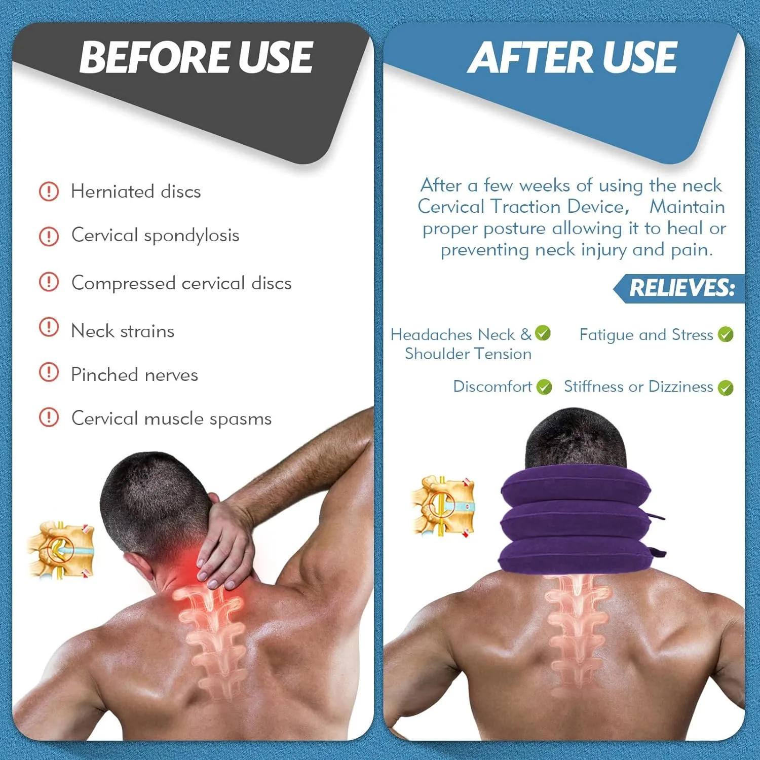 Neck Stretcher, Neck Traction Device, Cervical Traction Device, Neck Pain Relief, Adjustable Inflatable Neck Brace & Neck Stretcher Cervical Traction, Neck Decompression Home Use (Purple)